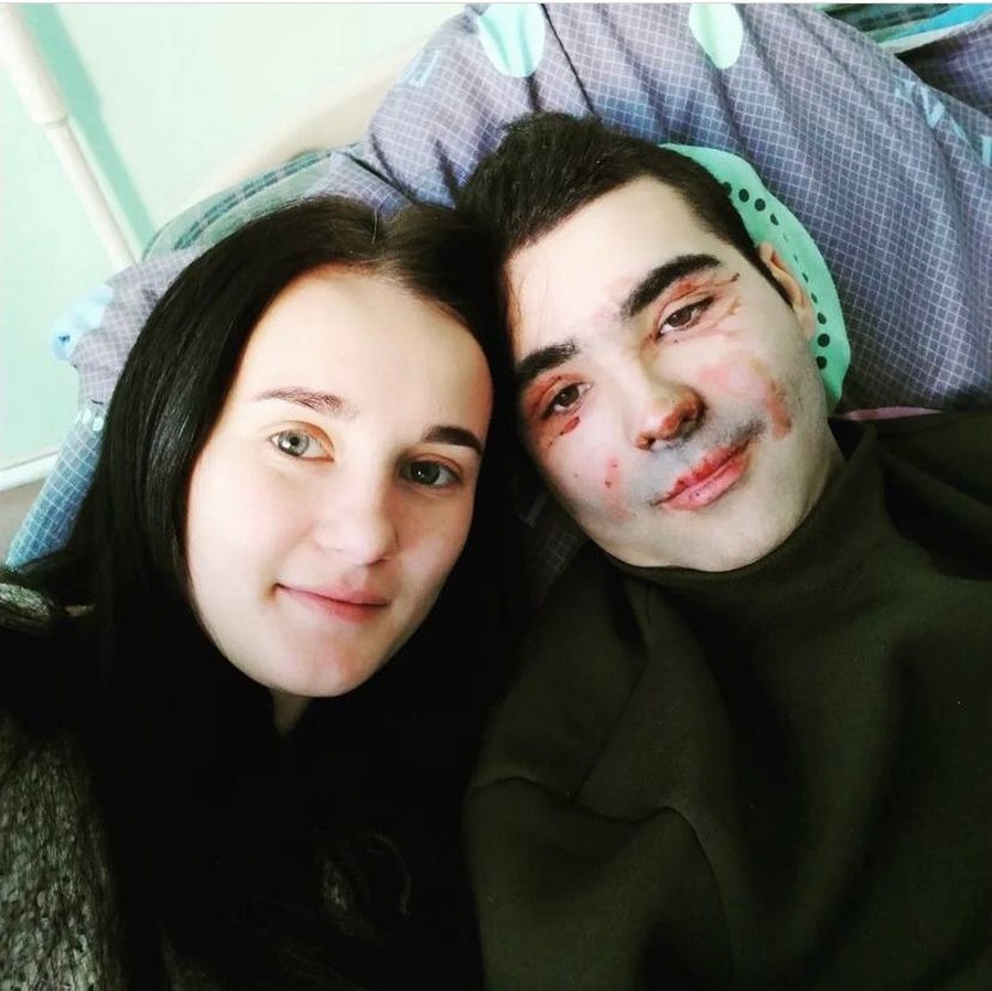 The story of Mariana, whose husband lost both legs